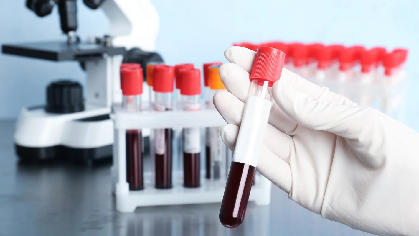 Гематология в клинике ДЕНИС - TOP Clinic DENIS