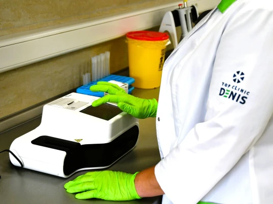 Анализитор UC-1000, анализ мочи методом отражательной фотометрии в комбинации с технологией CMOS-матрицы - TOP Clinic DENIS