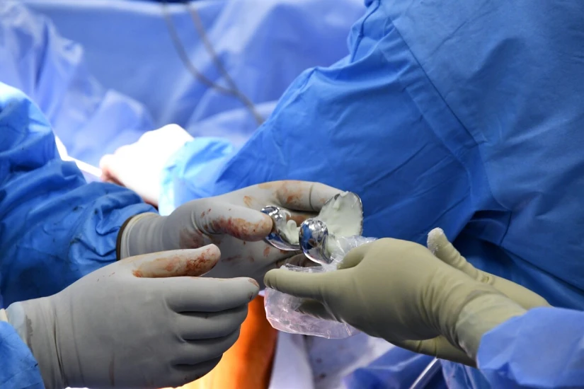 Все протезы — с сертификатами соответствия от производителей, завезены в Украину официально. - TOP Clinic DENIS