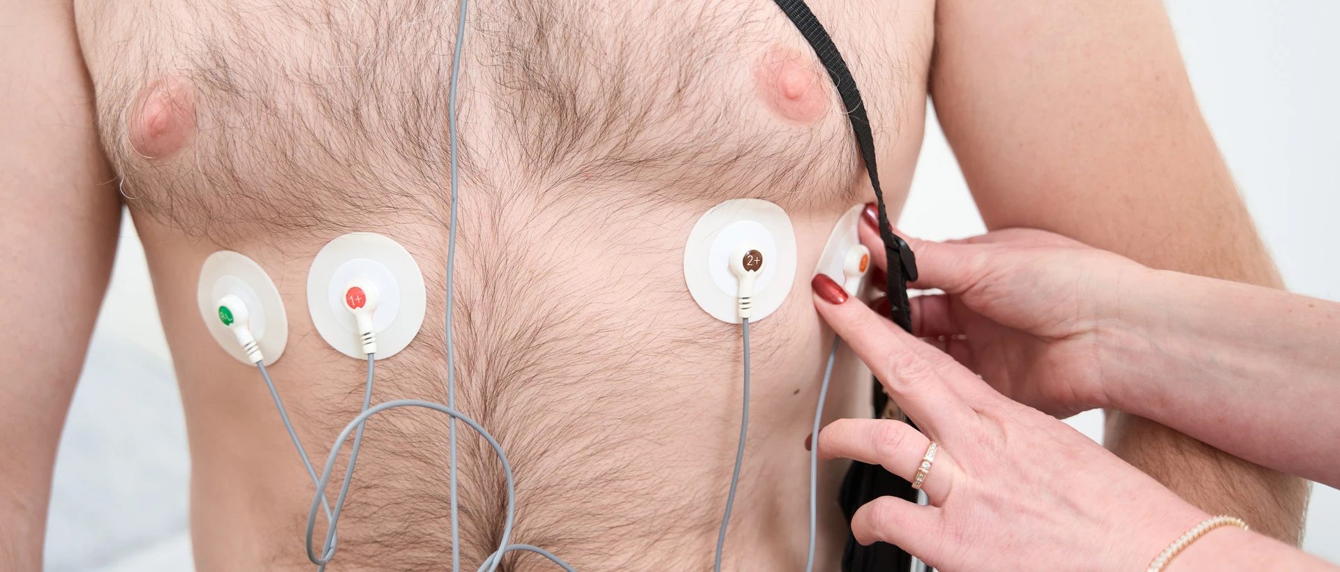 Экстрасистолия - TOP Clinic DENIS