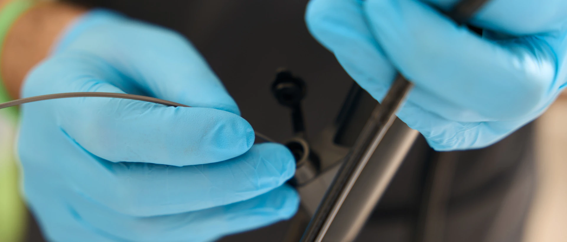 Виразковий коліт - TOP Clinic DENIS