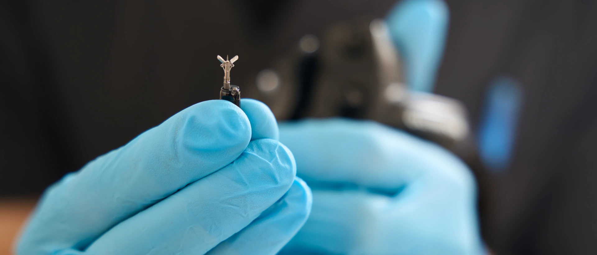 Функціональна диспепсія - TOP Clinic DENIS