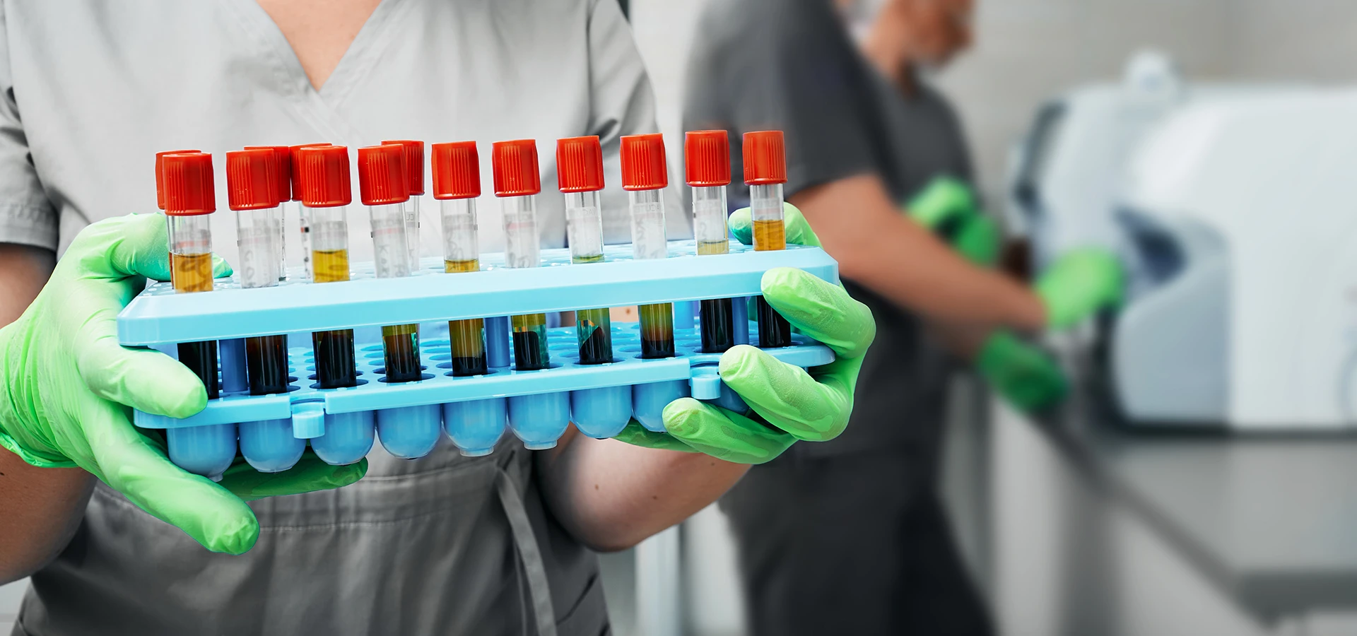 Быстрый тест на выявление IgM к гепатиту А - TOP Clinic DENIS