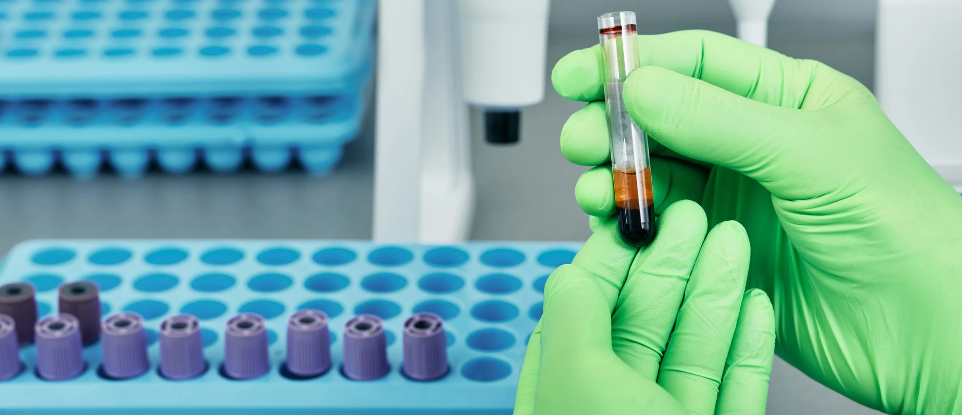 Лістеріоз - TOP Clinic DENIS