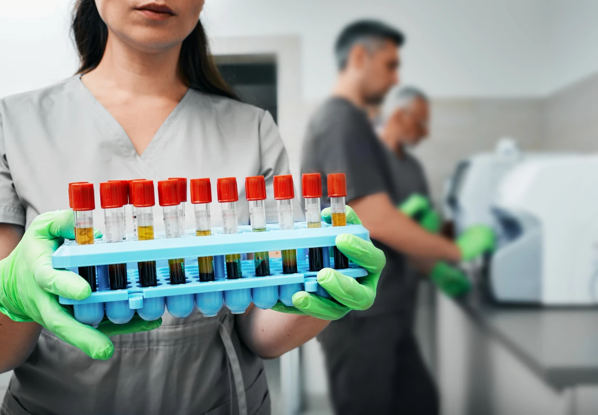 Інфекційний мононуклеоз - TOP Clinic DENIS