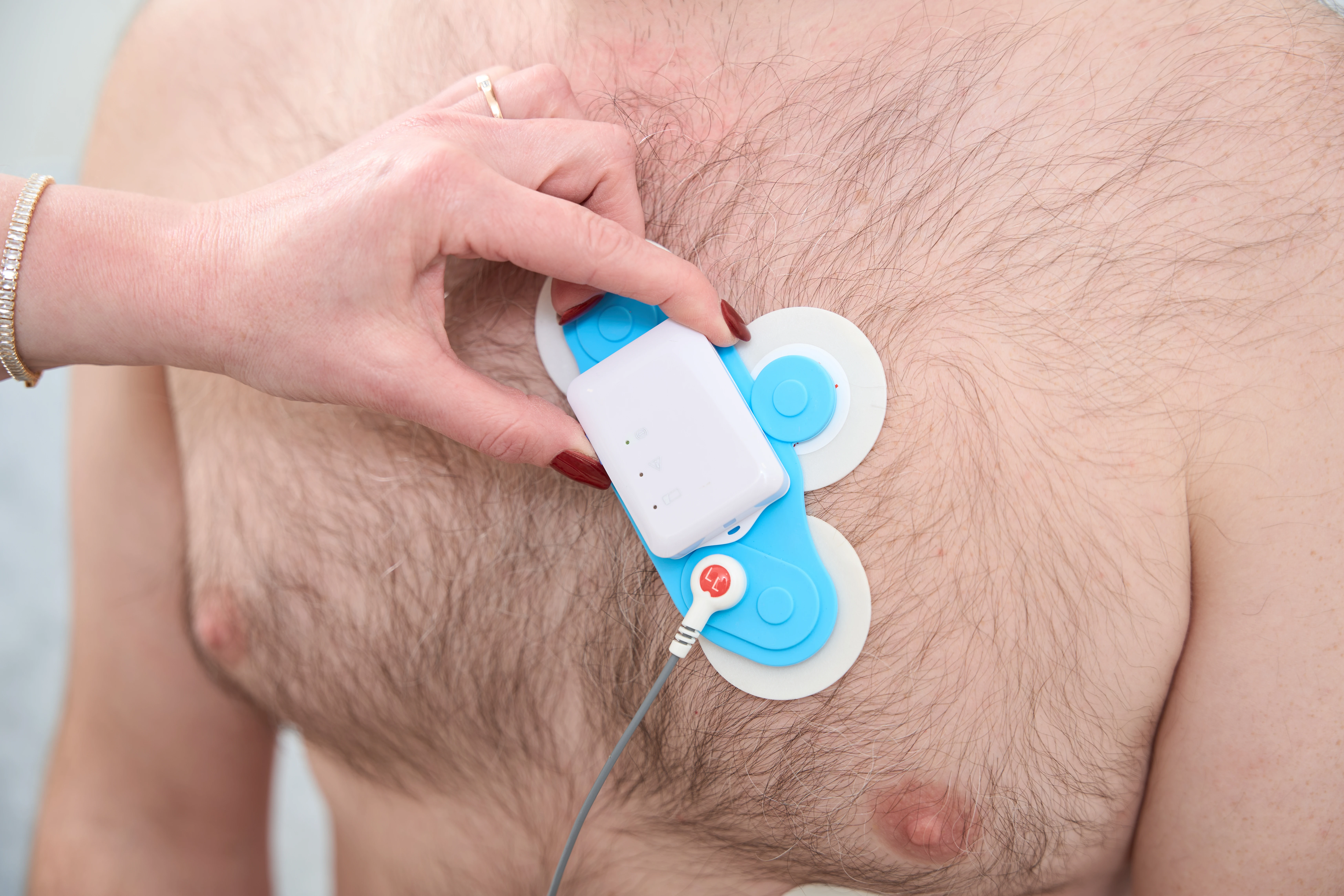 Фибрилляция и трепетание предсердий - TOP Clinic DENIS