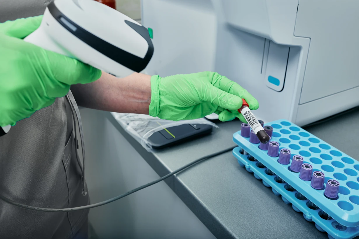 Сахарный диабет 1 типа - TOP Clinic DENIS