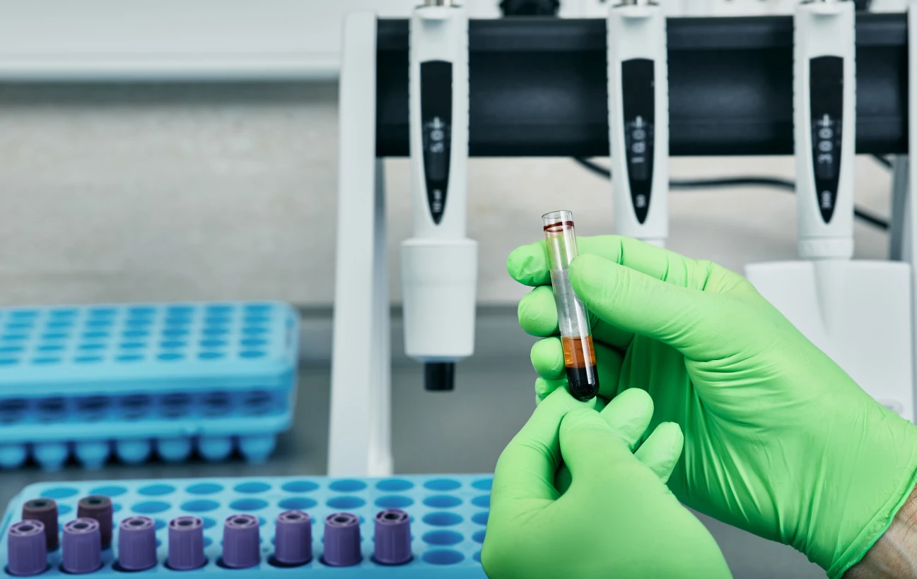 Гострий гепатит B - TOP Clinic DENIS