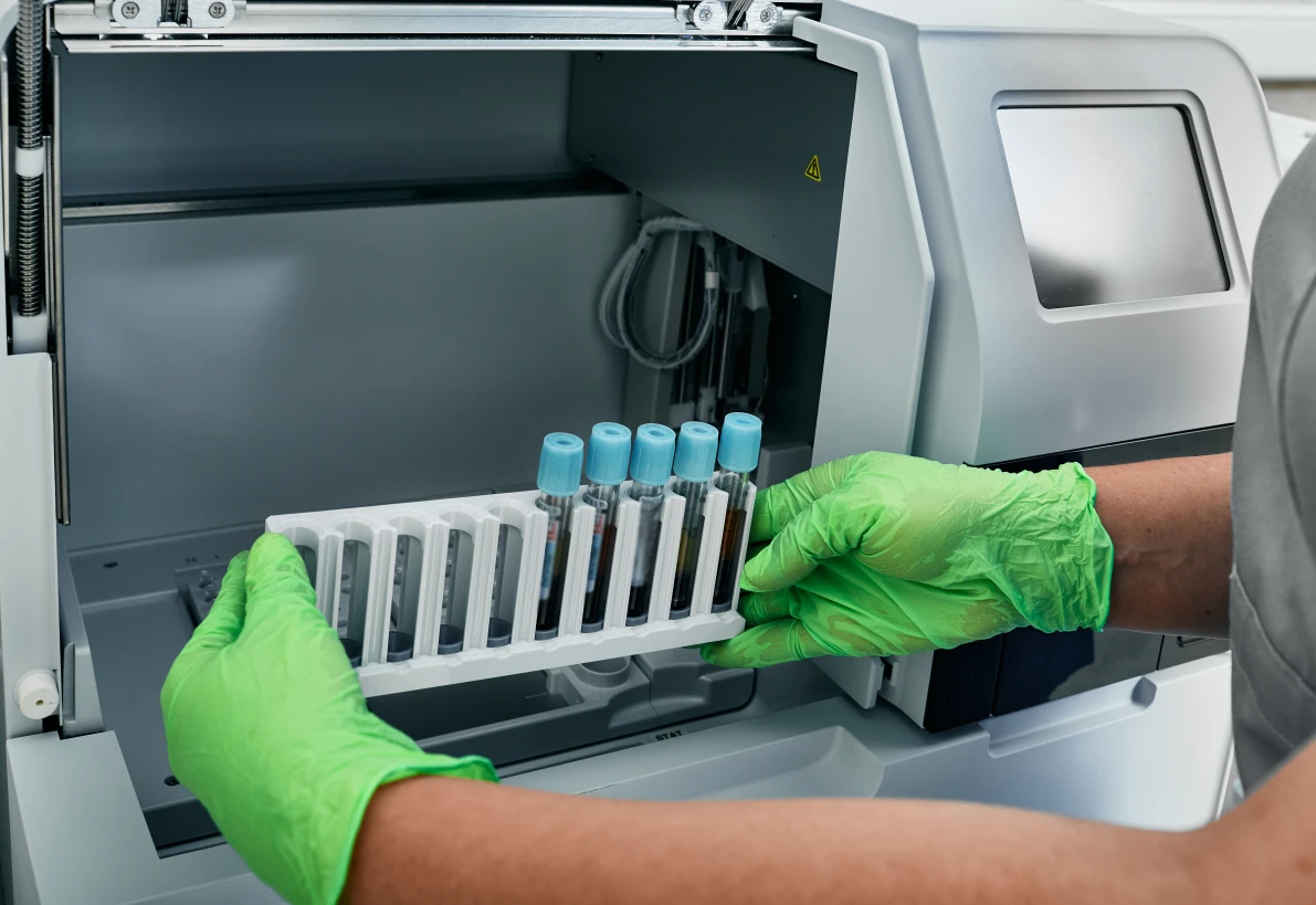 Витамин B12-дефицитная анемия - TOP Clinic DENIS