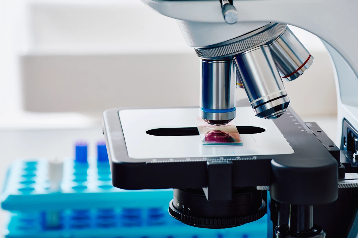 Серповидно-клеточные нарушения - TOP Clinic DENIS