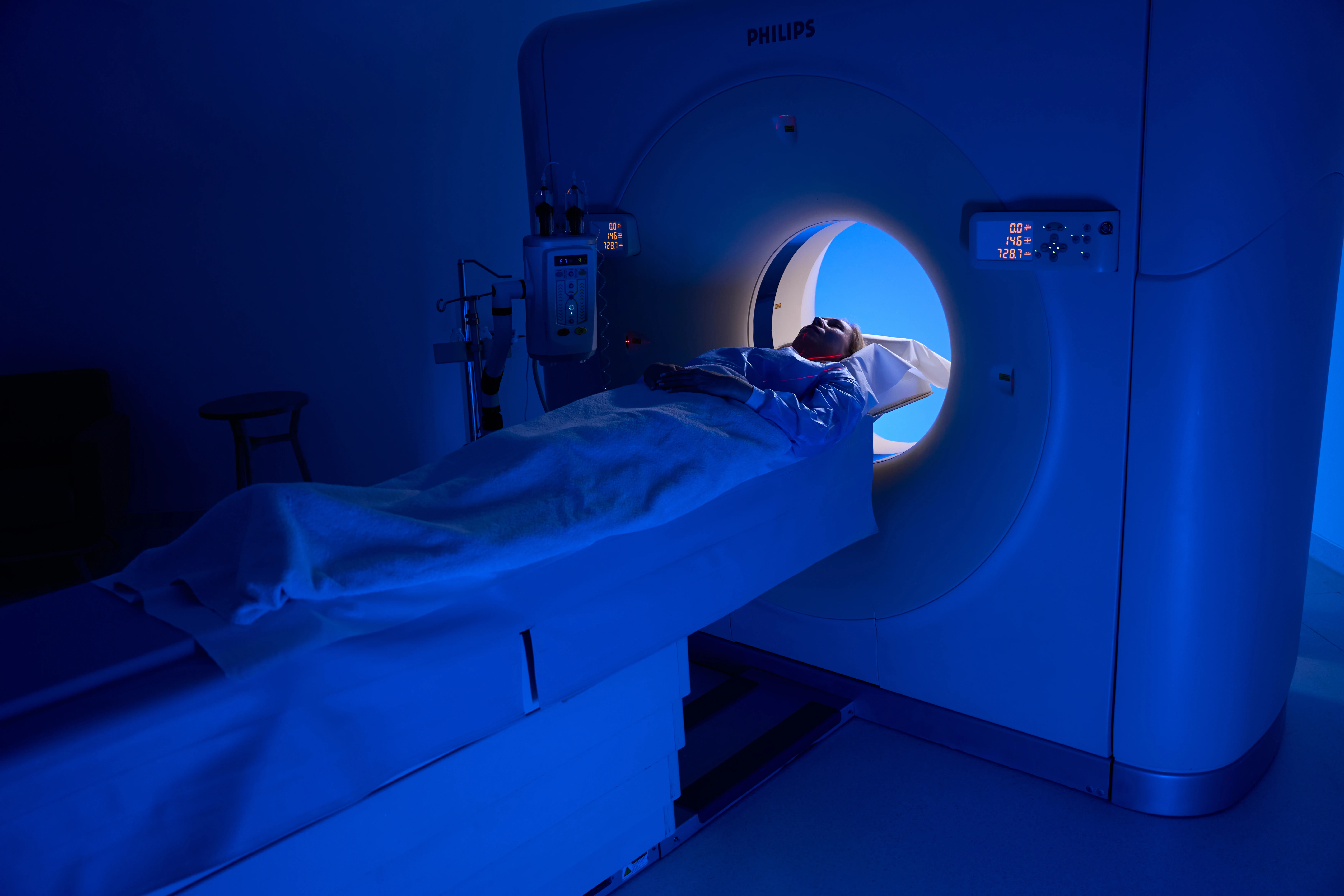 Туберкулёз нервной системы - TOP Clinic DENIS