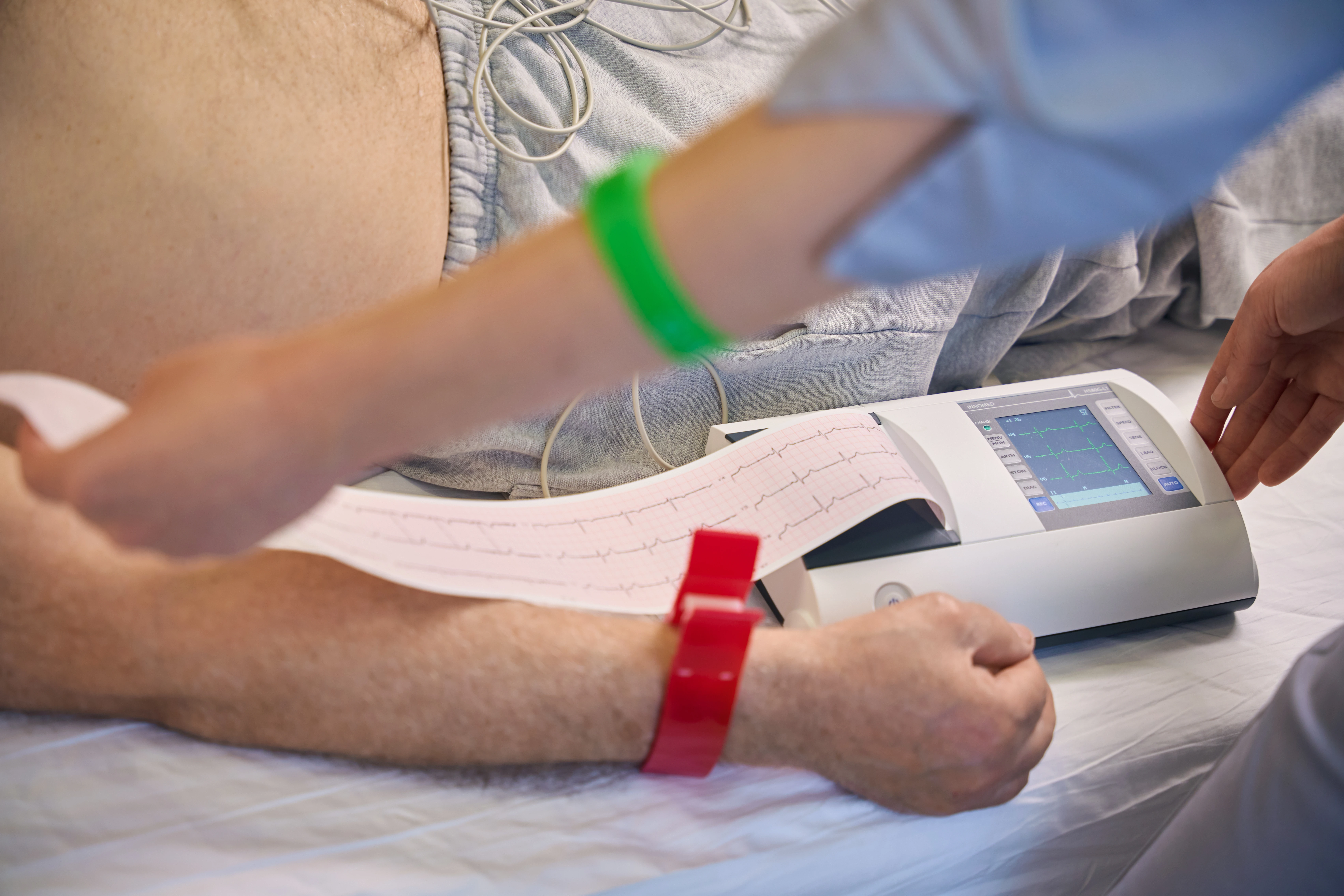 Аневризма та розшарування аорти - TOP Clinic DENIS