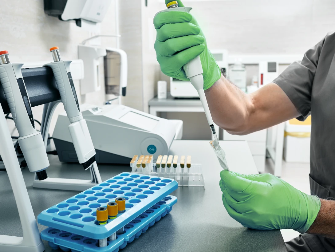 Амілоїдоз - TOP Clinic DENIS