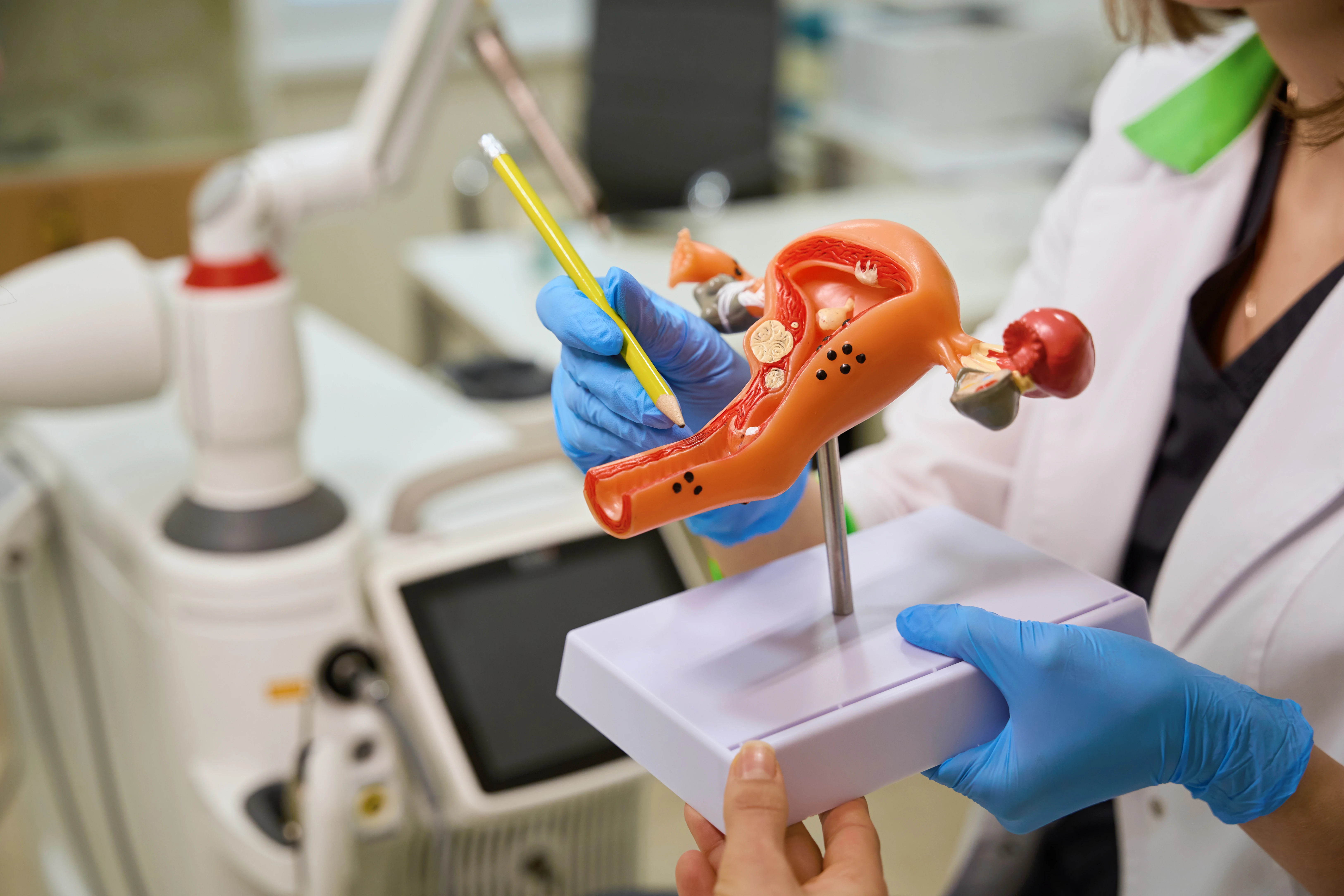 Дисфункція яєчників - TOP Clinic DENIS