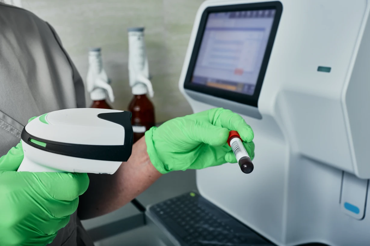 Непереносимість лактози - TOP Clinic DENIS