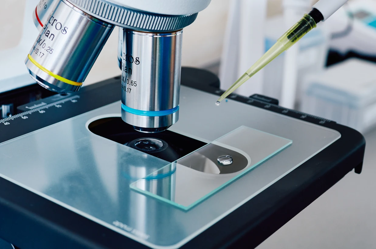 Подагричний артрит - TOP Clinic DENIS