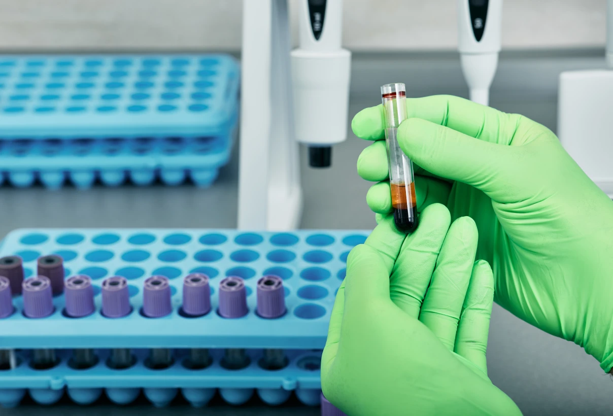 Актиномикоз - TOP Clinic DENIS