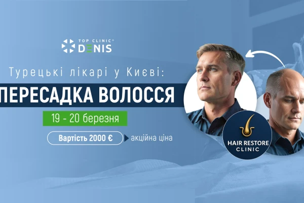 В Клініці будуть проводити пересадку волосся турецькі лікарі - TOP Clinic DENIS