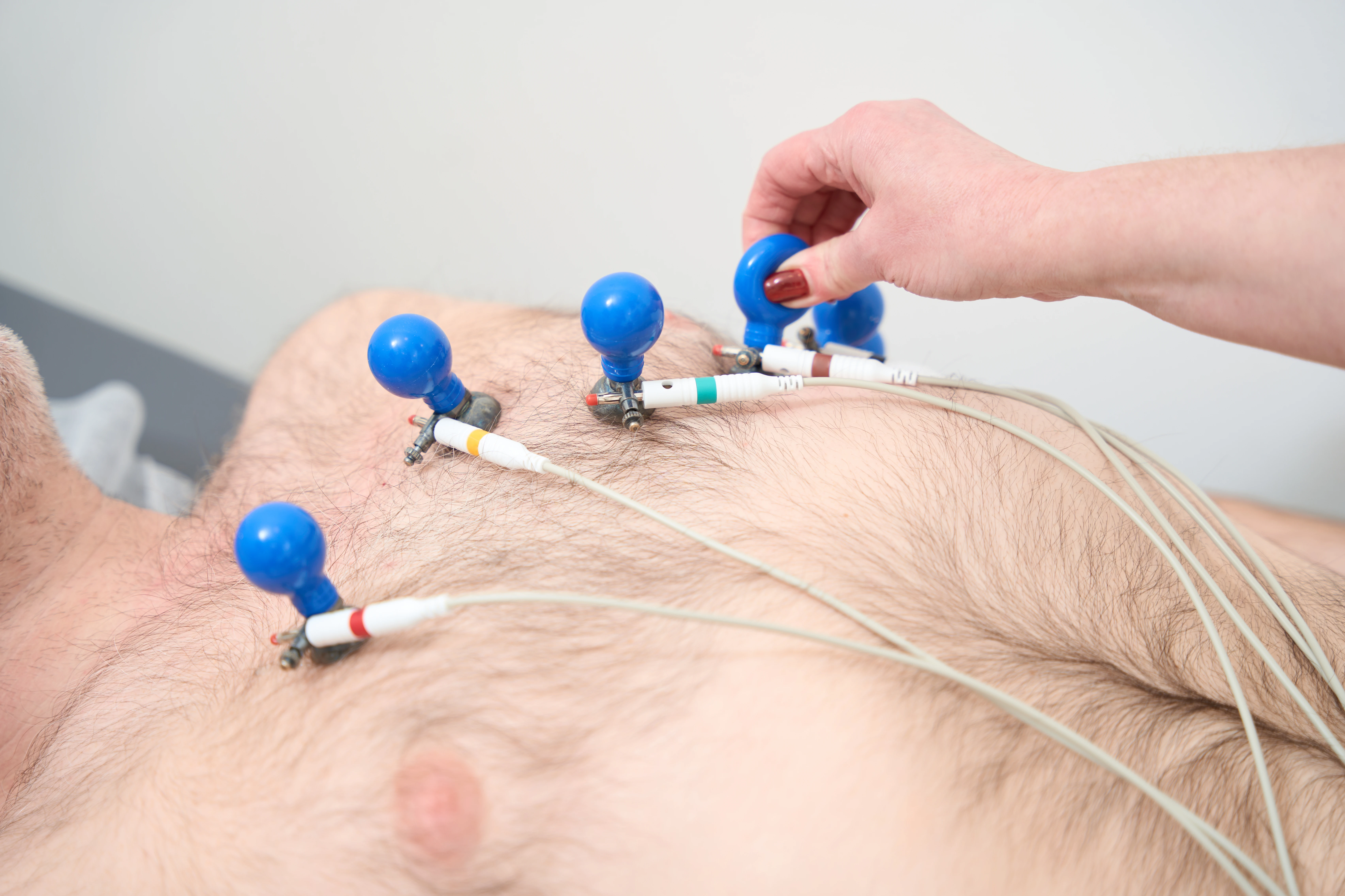 Кардіоміопатія - TOP Clinic DENIS