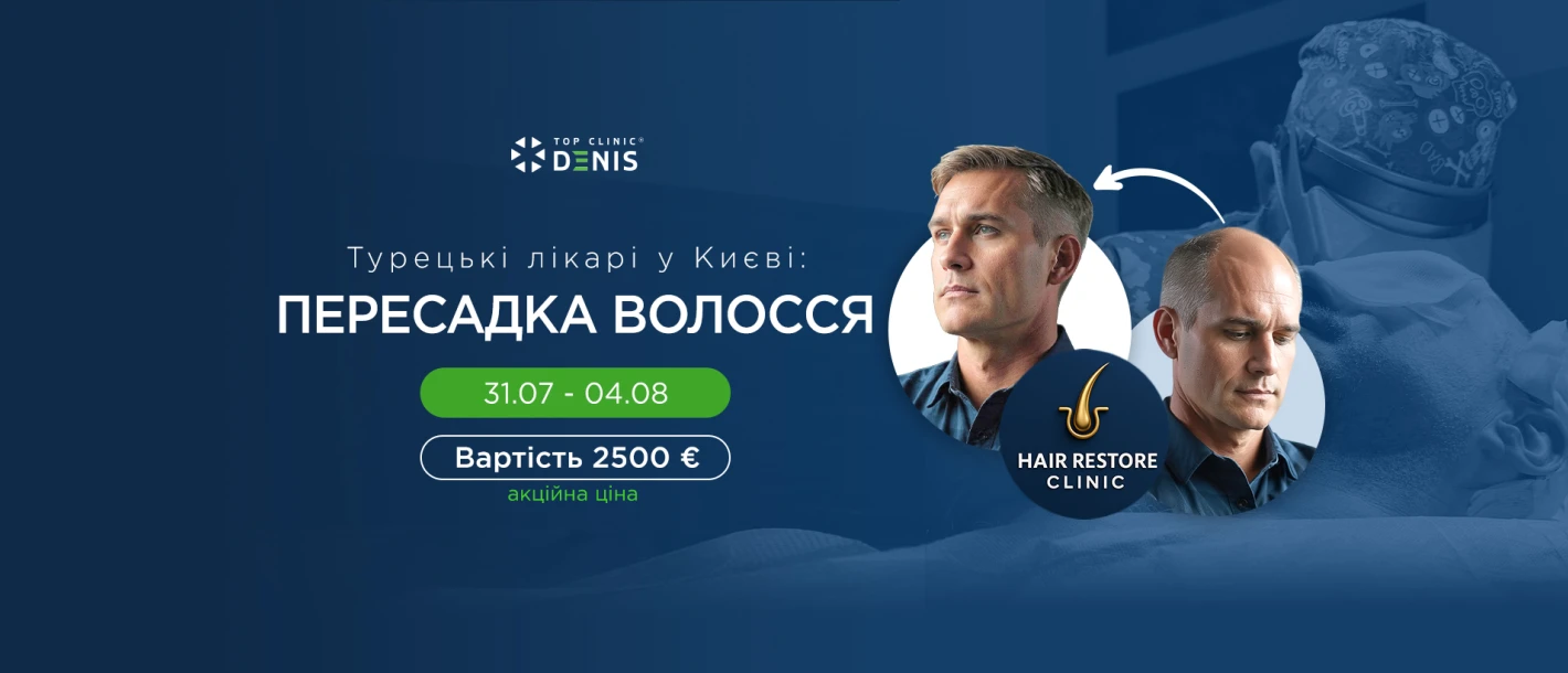 В Клініці будуть проводити пересадку волосся турецькі лікарі - TOP Clinic DENIS